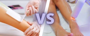 لیزر یا اپیلاسیون، کدام یک بهتر است؟