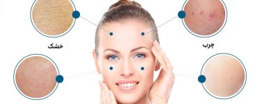 با انواع پوست آشنا شوید