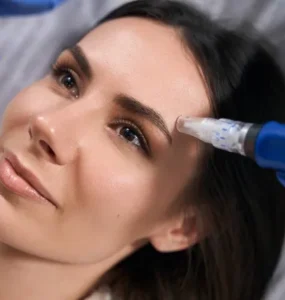 میکرونیدلینگ ابرو چیست؟