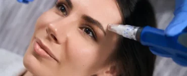 میکرونیدلینگ ابرو چیست؟