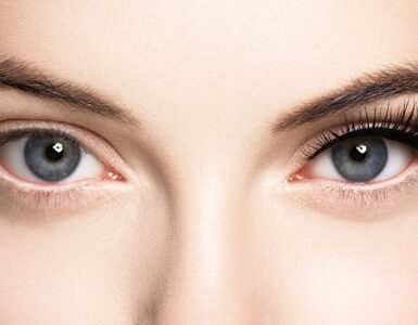 کاشت مژه موقت