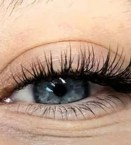 کاشت هیدن مژه