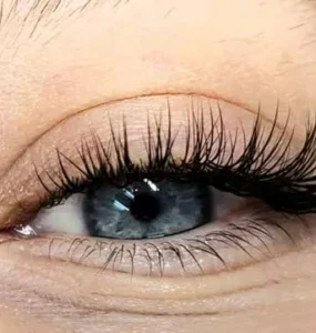 کاشت هیدن مژه