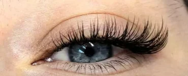 کاشت هیدن مژه