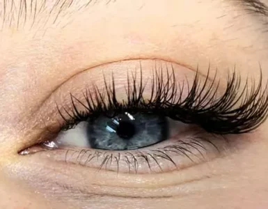 کاشت هیدن مژه