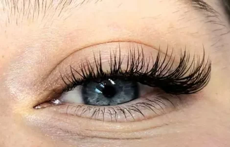 کاشت هیدن مژه